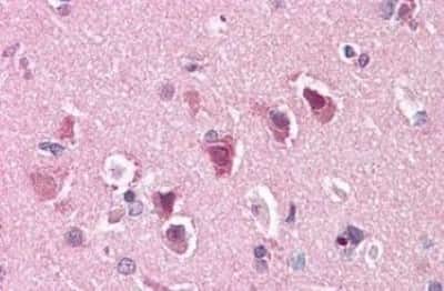 Immunohistochemistry-Paraffin: ENT1 Antibody [NBP3-14311] - ENT1 antibody IHC of human brain, cortex. Immunohistochemistry of formalin-fixed, paraffin-embedded tissue after heat-induced antigen retrieval.